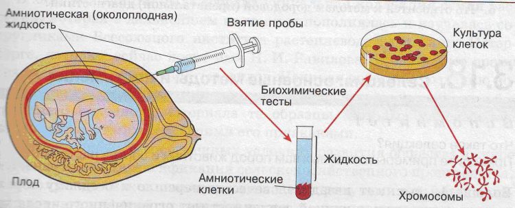 На какой из изображенных на рисунке стадий онтогенеза невозможно определить пол будущего ребенка