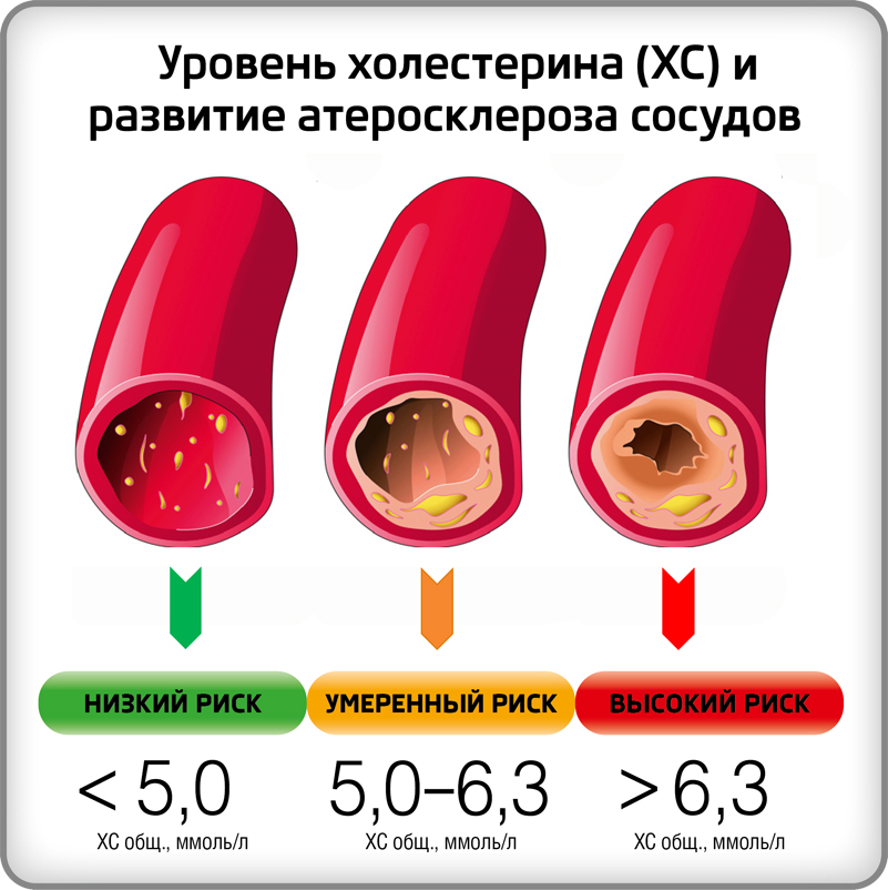 Презентация на тему холестерин