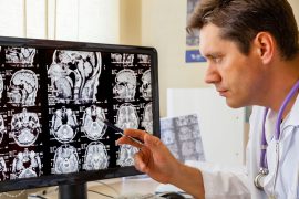 Сотрясение мозга: причины, симптомы и методы лечения
